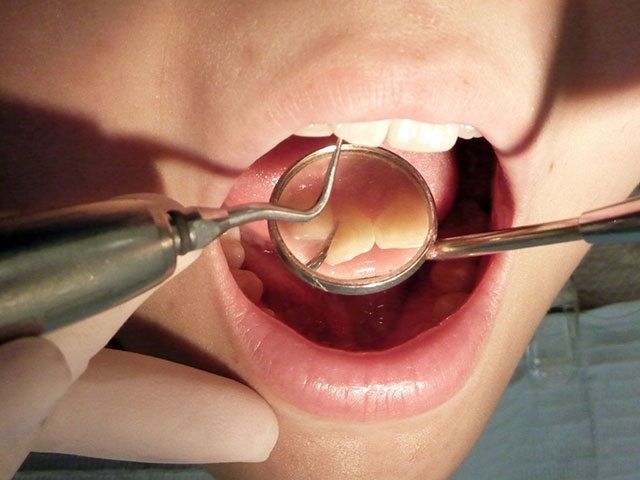 歯、歯肉、お口の中全体の状態をチェック
